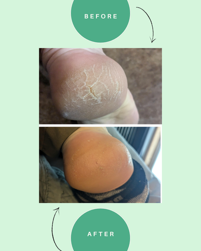 Instant Foot Renewal Spray