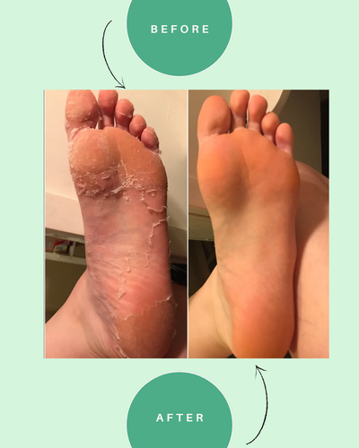 Instant Foot Renewal Spray