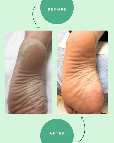 Instant Foot Renewal Spray