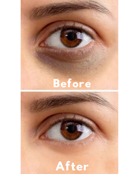 Advanced Peptide Collagen Hydrogel Eye Patch
