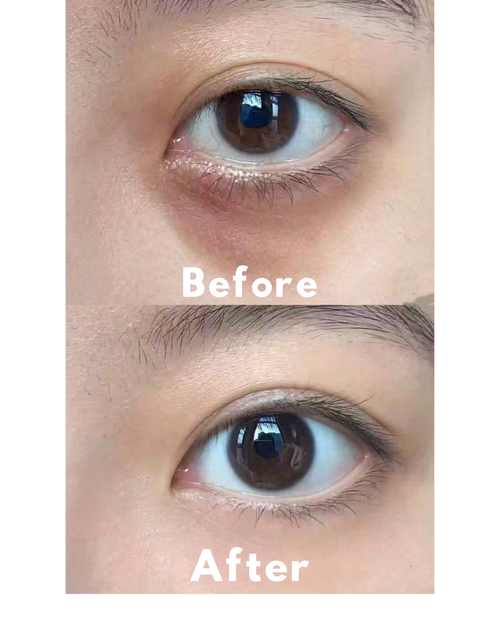 Advanced Peptide Collagen Hydrogel Eye Patch