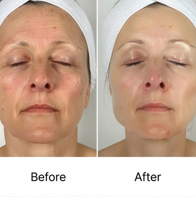 Deep Hydration Collagen Mask (with PDRN & Collagen)