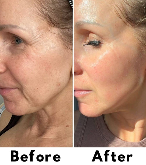 Liquid Micro needling Spicule Serum