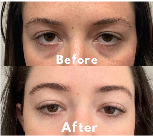 Advanced Peptide Collagen Hydrogel Eye Patch